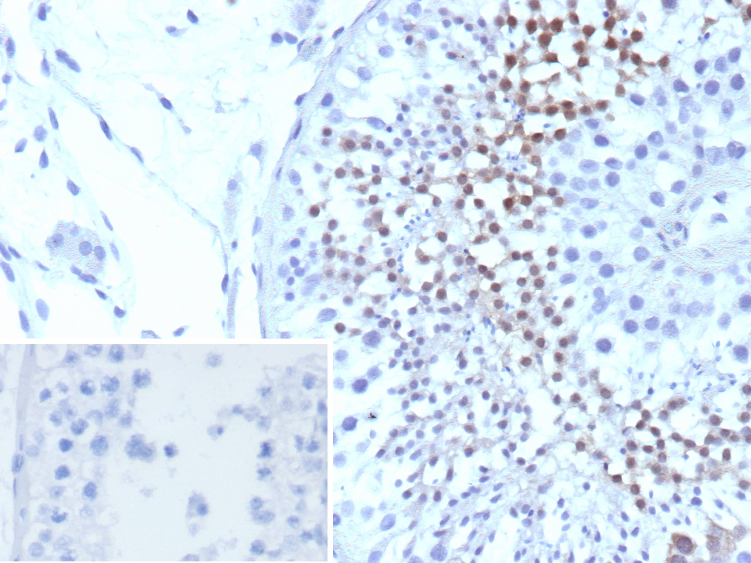 Centrin 1 Antibody (CETN1/9880)