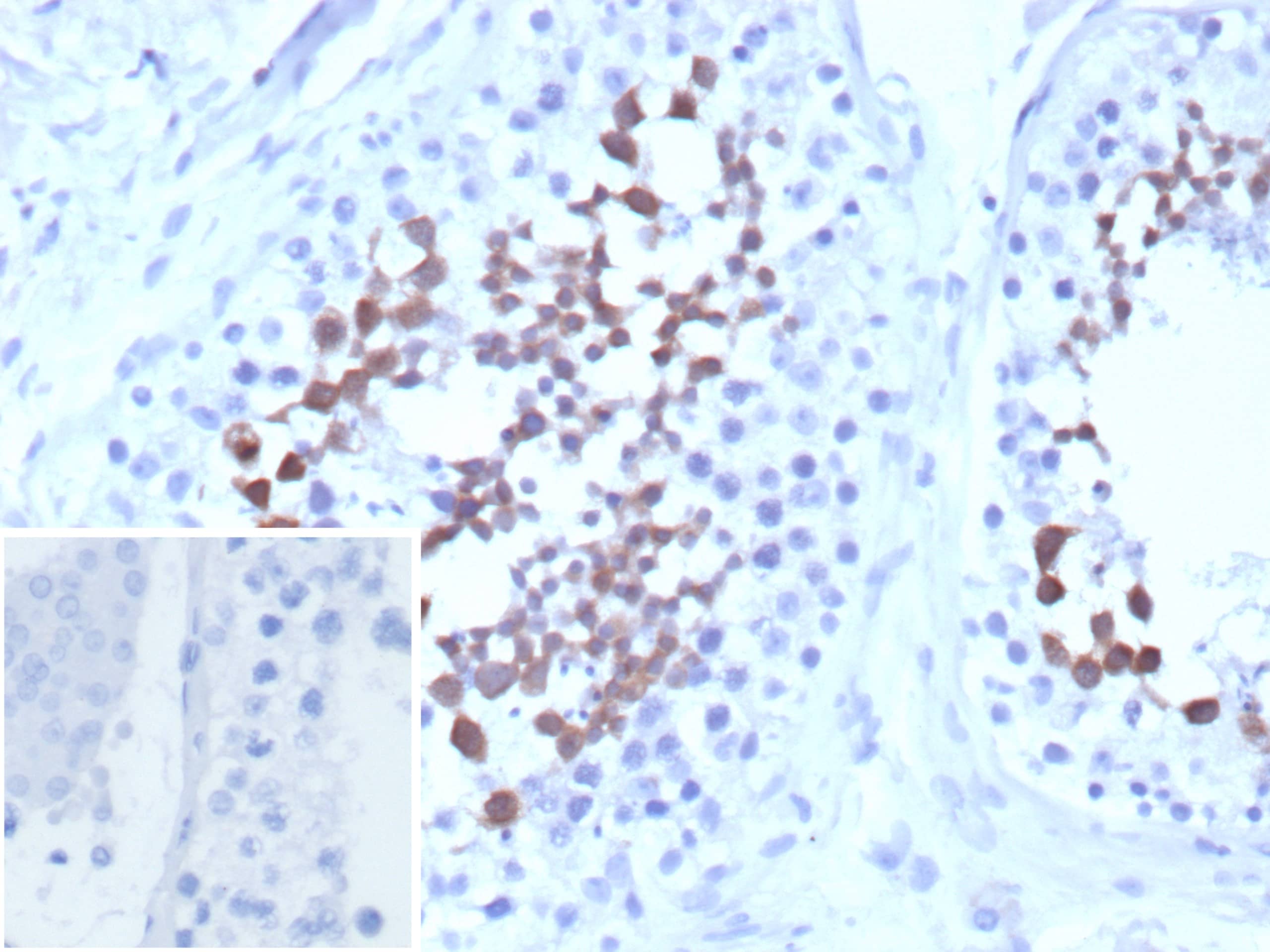 Centrin 1 Antibody (CETN1/9878)