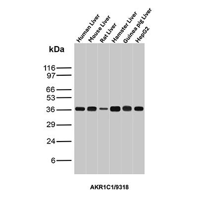 Aldo-keto Reductase 1C1/AKR1C1 Antibody (AKR1C1/9318)