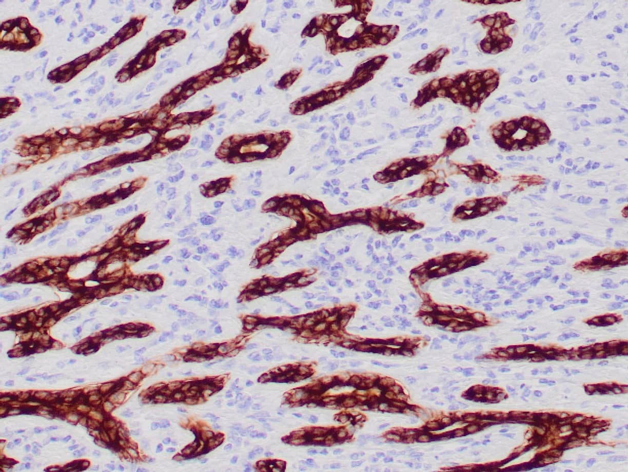 Cytokeratin 7, 8 Antibody (CAM5.2)