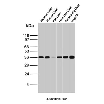 Aldo-keto Reductase 1C1/AKR1C1 Antibody (AKR1C1/9062)