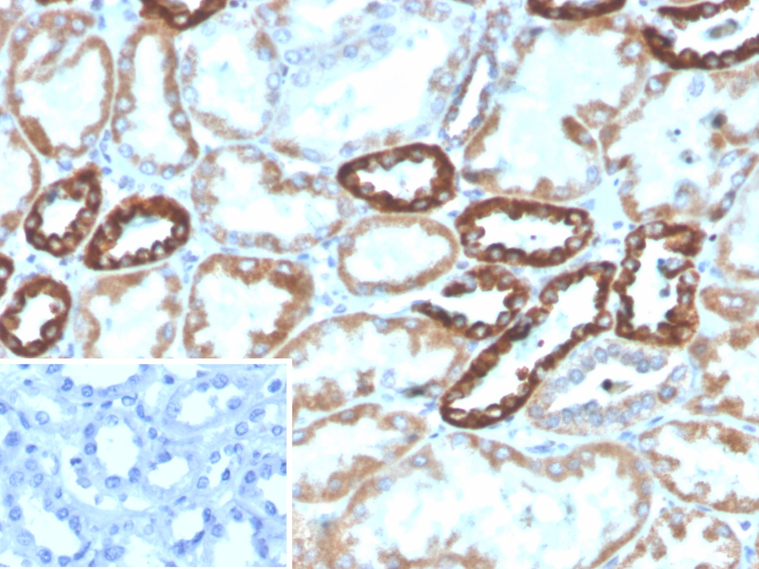 PLA2R1 Antibody (PLA2R1/4891)