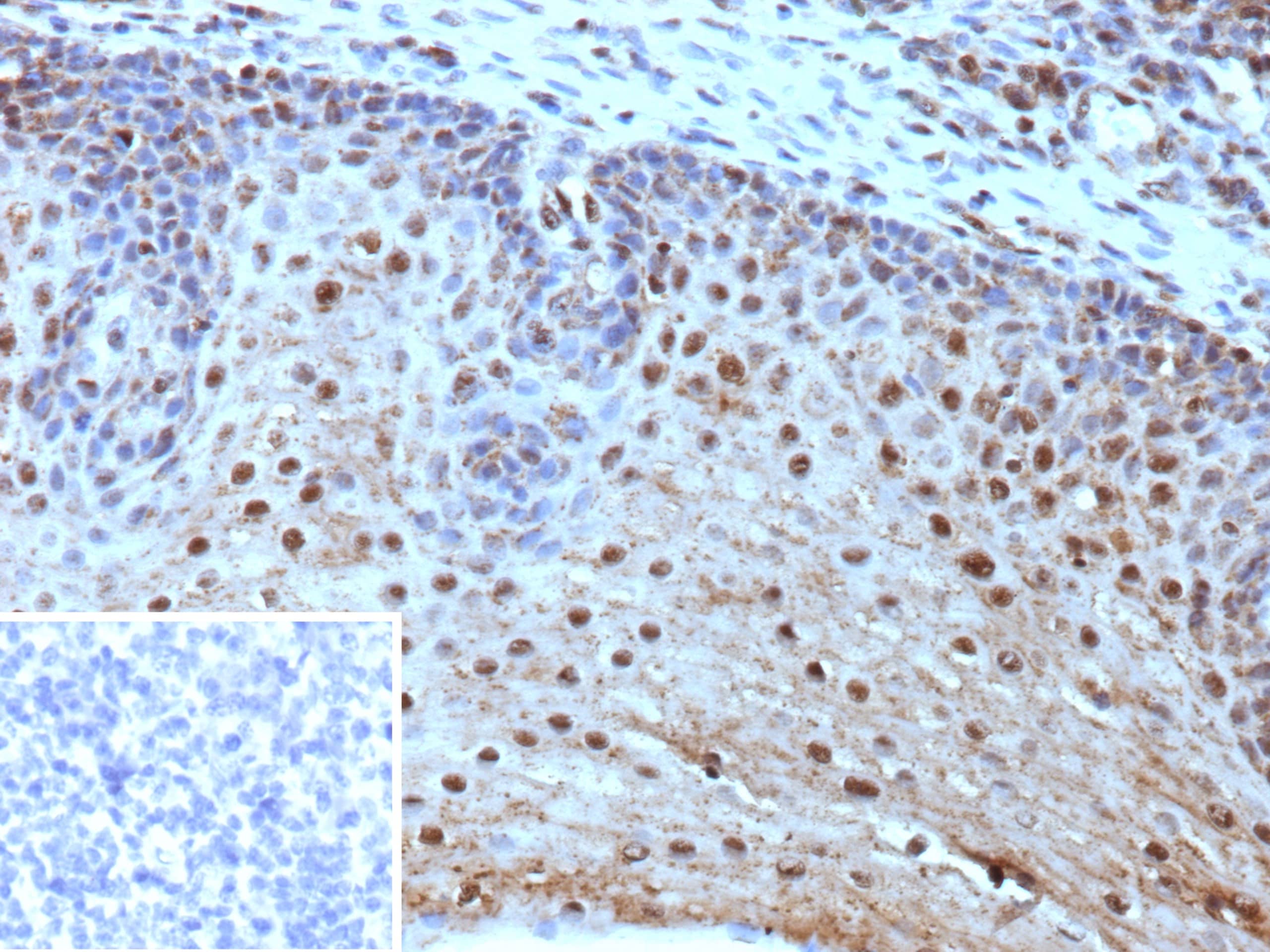 HLA-E Antibody (HLAE/9468)