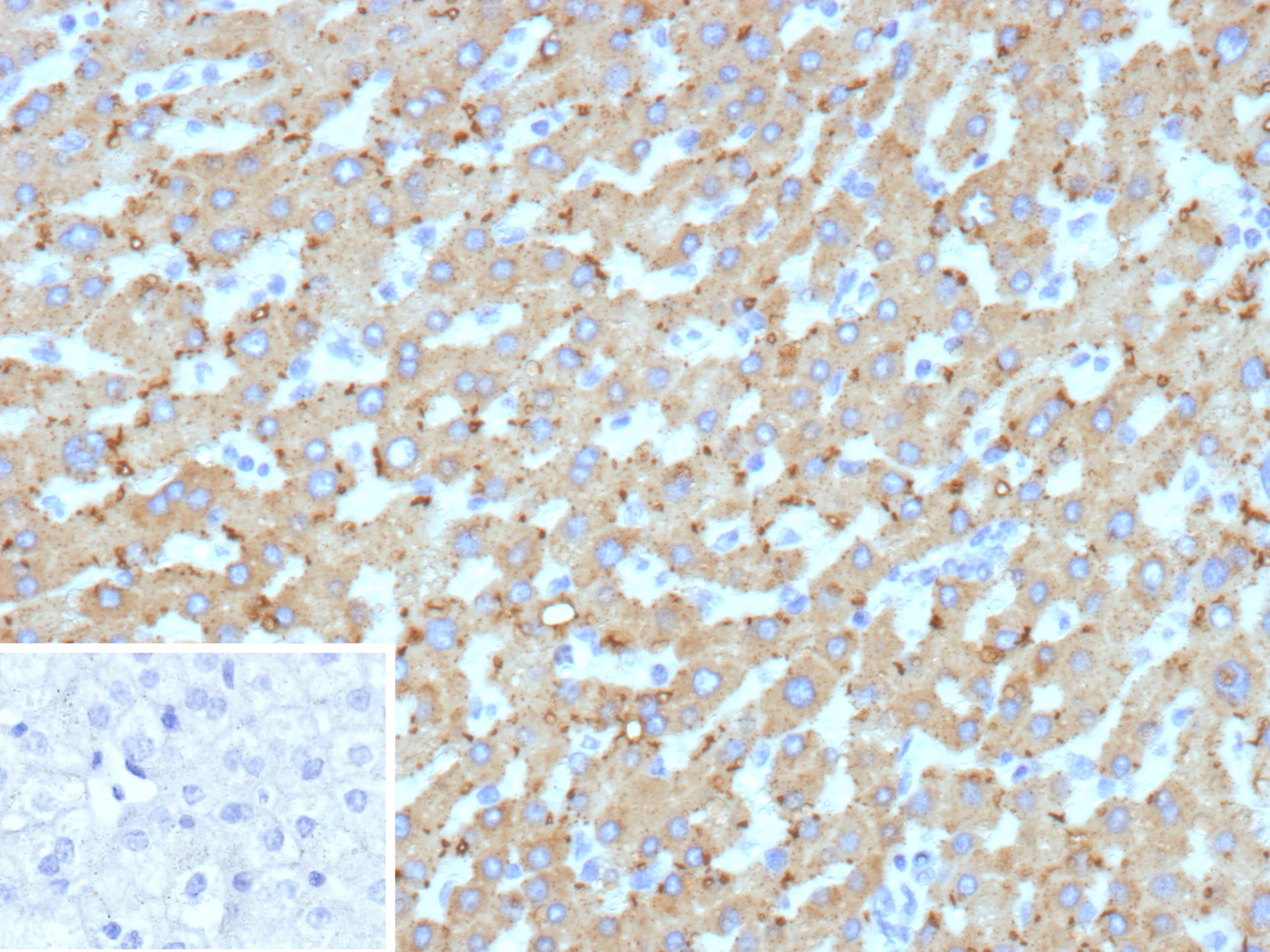 HSD17B13 Antibody (HSD17B13/13110)