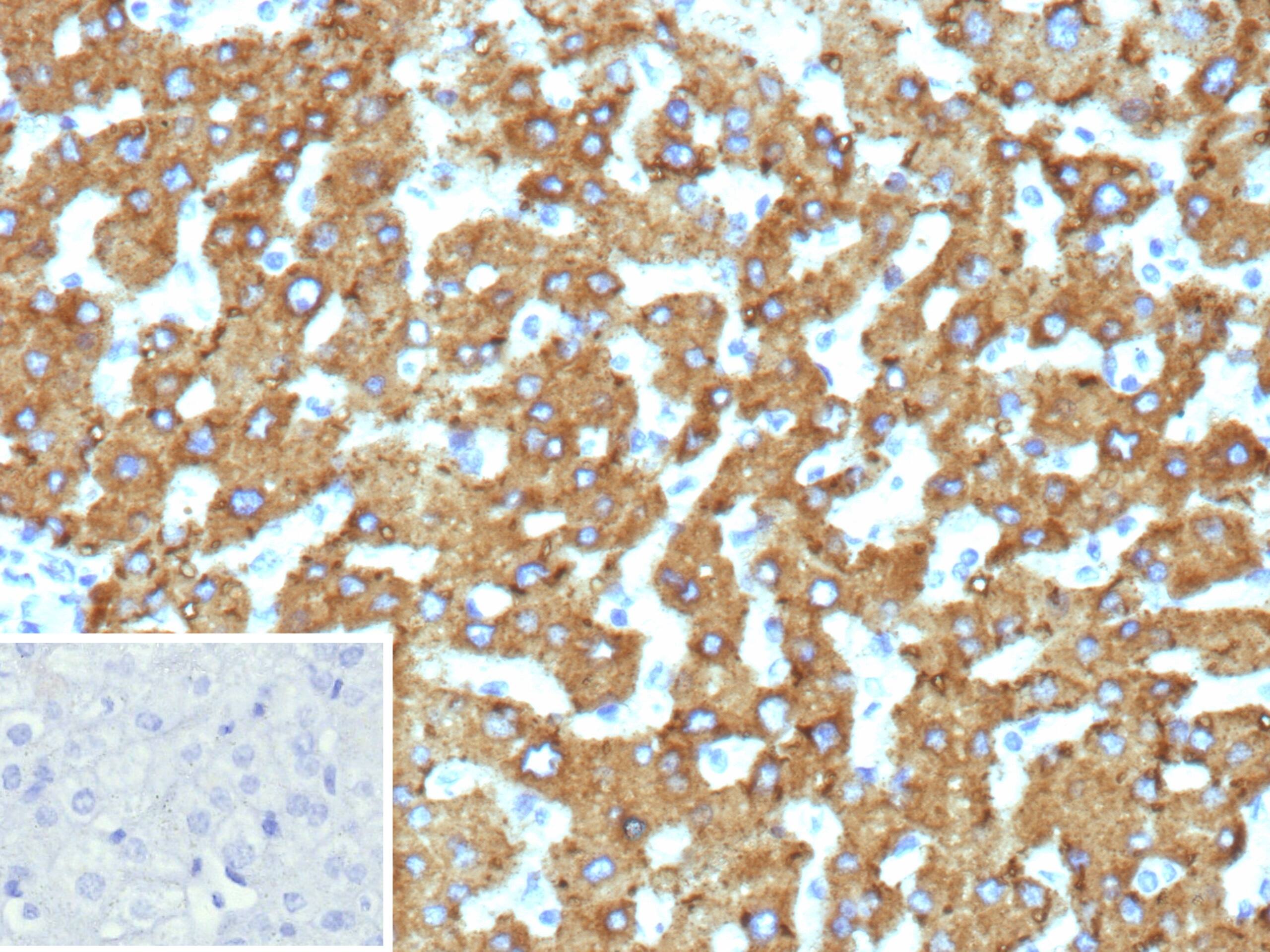 HSD17B13 Antibody (HSD17B13/13104)