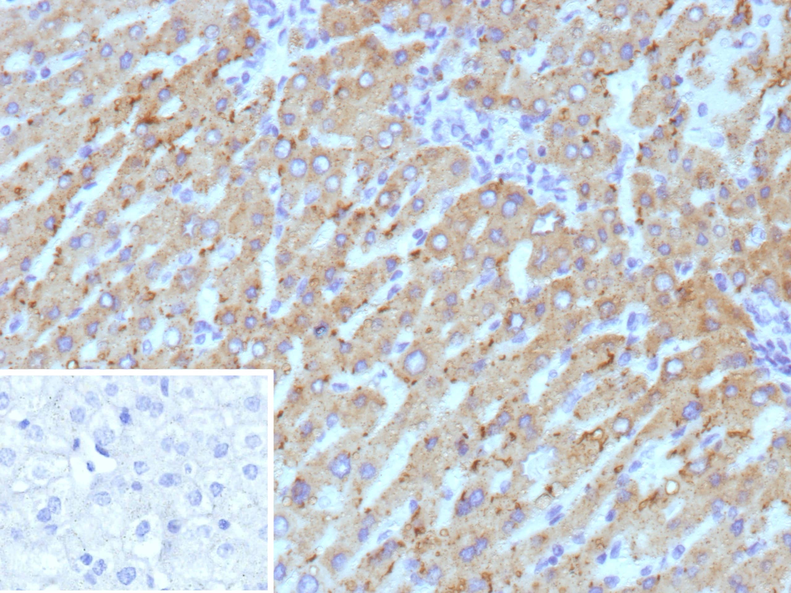 HSD17B13 Antibody (HSD17B13/13108)