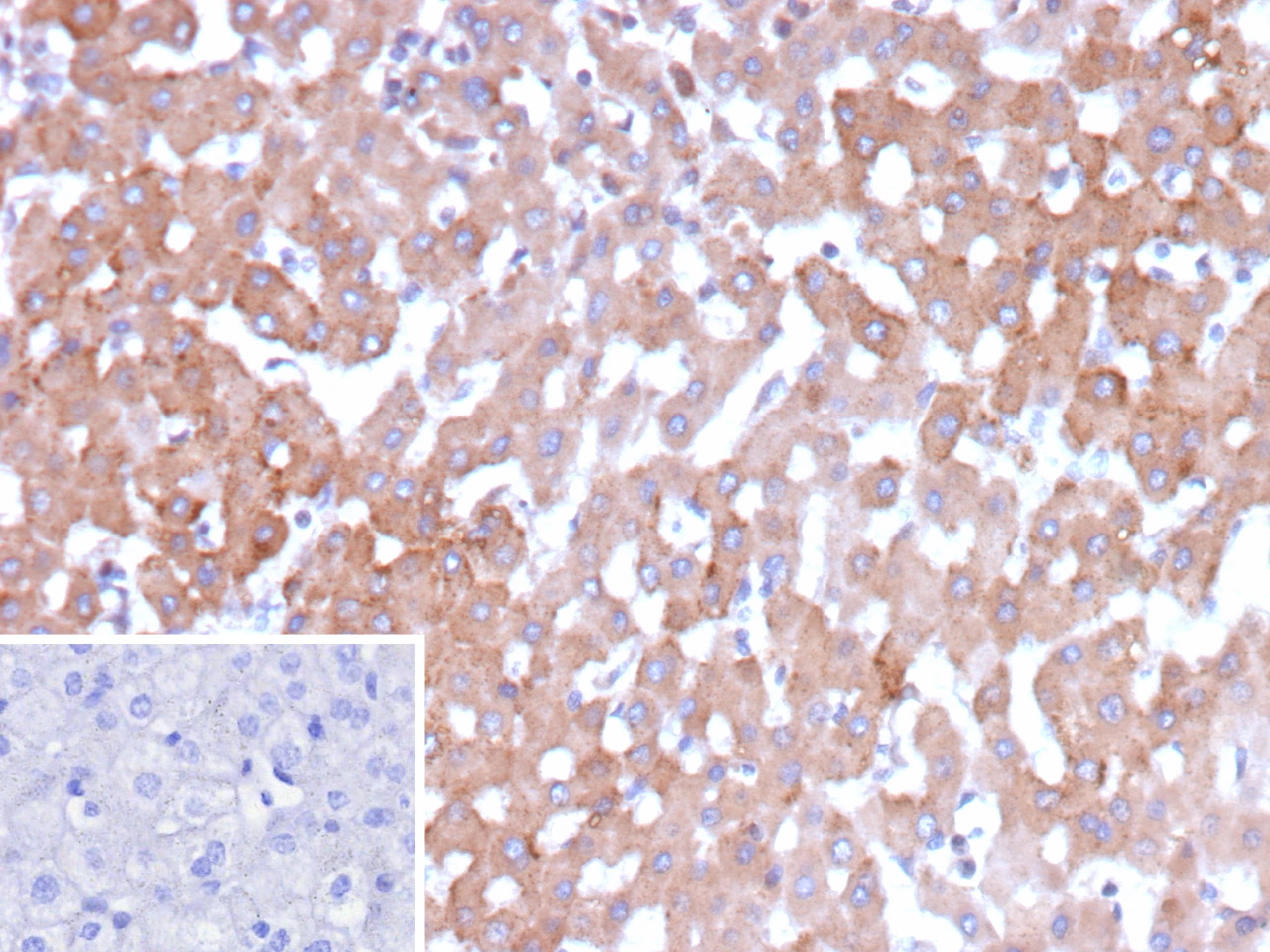 HSD17B13 Antibody (HSD17B13/13109)
