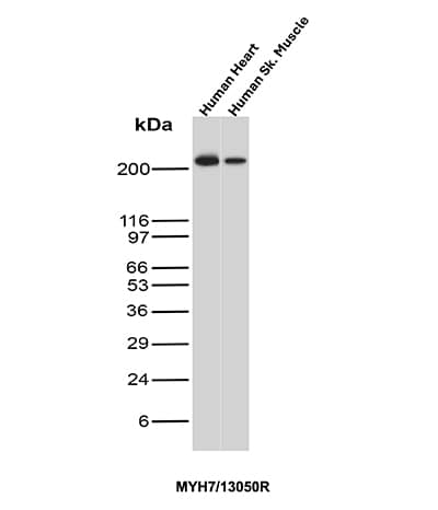 MYH7 Antibody (MYH7/13050R)