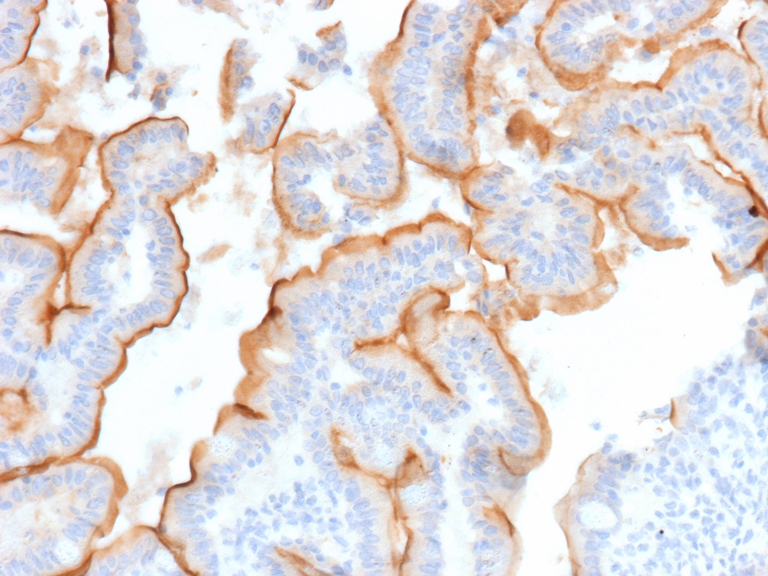 MUC13 Antibody (MUC13/13112)