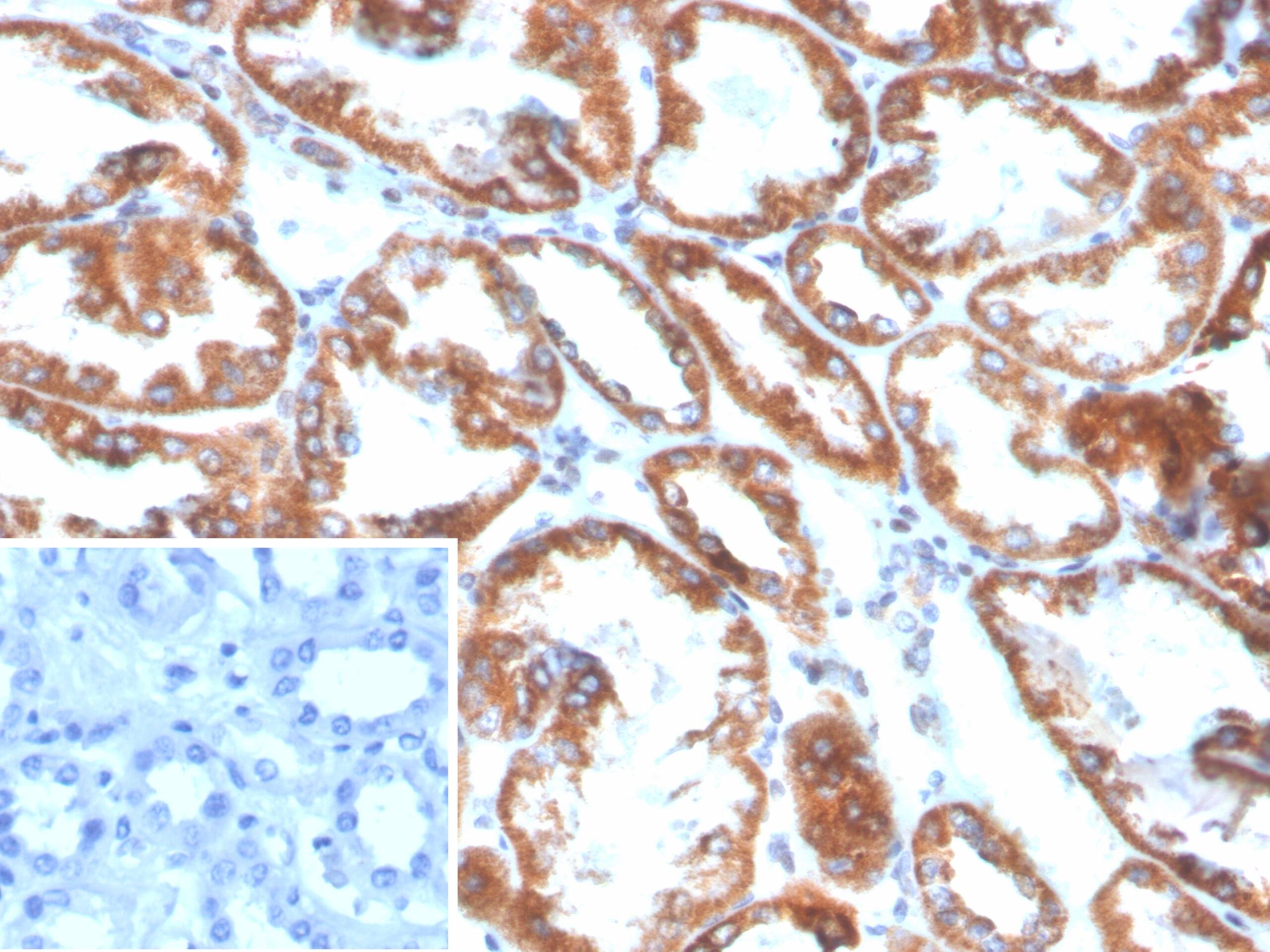 PLA2R1 Antibody (PLA2R1/4898)