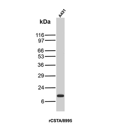 Cystatin A Antibody (rCSTA/8995)