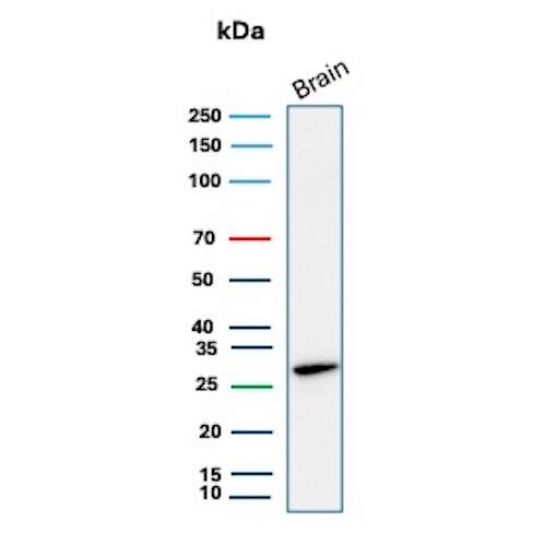 Calbindin D-28K Antibody (rCALB1/13280)