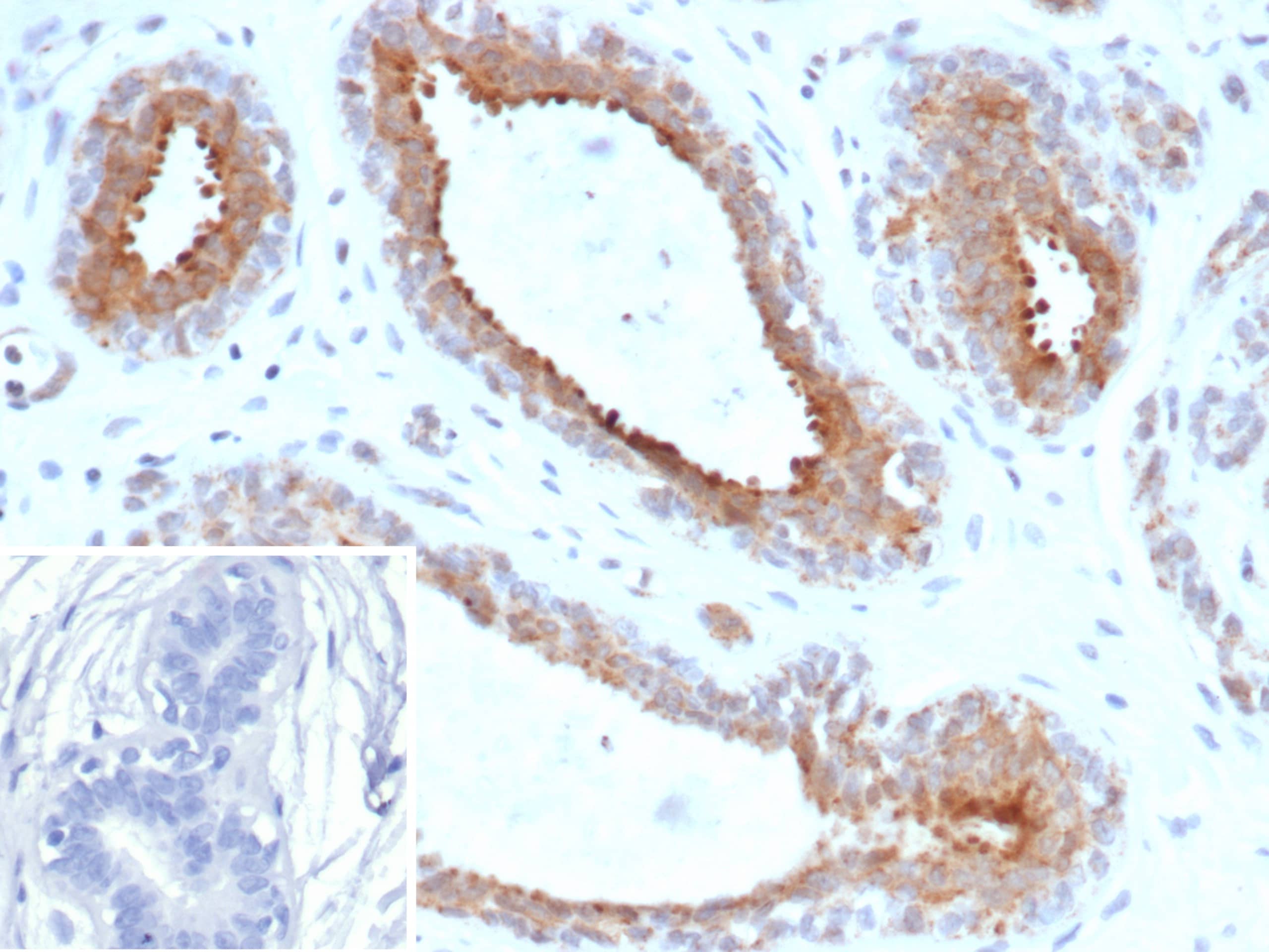 BAP1 Antibody (BAP1/13501R)