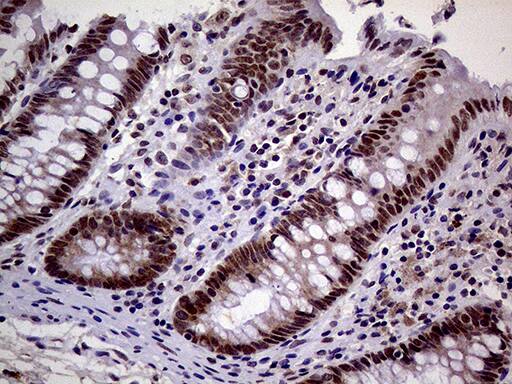 MAGEB4 Antibody (OTI3H2) Immunohistochemistry;MAGEB4 Antibody (OTI3H2)[NBP3-44712]-