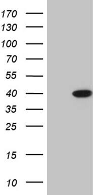 ERLIN1 Antibody (OTI4C11) Western Blot;ERLIN1 Antibody (OTI4C11)[NBP3-44917]-