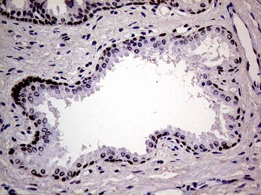 MAGEB4 Antibody (OTI3H2) Immunohistochemistry;MAGEB4 Antibody (OTI3H2)[NBP3-44712]-