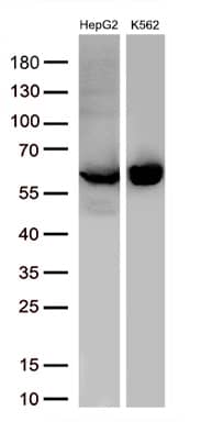 Pyruvate Kinase Antibody (OTI1H4) Western Blot;Pyruvate Kinase Antibody (OTI1H4)[NBP3-44636]-