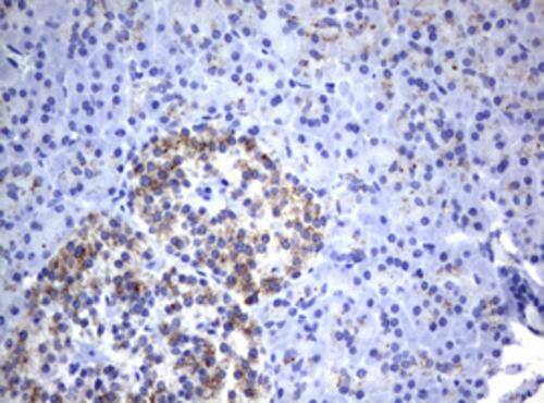 NEU-1/Sialidase-1 Antibody (OTI3B3) Immunohistochemistry;NEU-1/Sialidase-1 Antibody (OTI3B3)[NBP3-44669]-