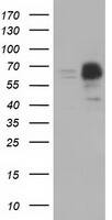 PEX5 Antibody (OTI6E9) Western Blot;PEX5 Antibody (OTI6E9)[NBP3-44637]-