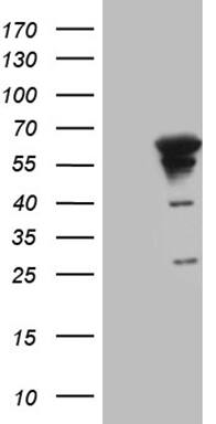 Myotilin Antibody (OTI10A11) Western Blot;Myotilin Antibody (OTI10A11)[NBP3-44775]-