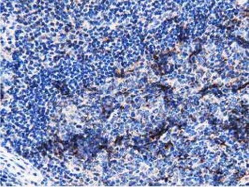 PEPD Antibody (OTI5D5) Immunohistochemistry;PEPD Antibody (OTI5D5)[NBP3-44638]-