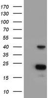 PECI Antibody (OTI2H10) Western Blot;PECI Antibody (OTI2H10)[NBP3-44645]-
