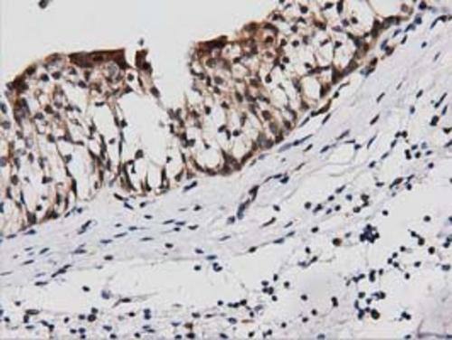 PEPD Antibody (OTI1B7) Immunohistochemistry;PEPD Antibody (OTI1B7)[NBP3-44639]-