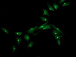 XPNPEP3 Antibody (OTI2D5) Immunocytochemistry/ Immunofluorescence;XPNPEP3 Antibody (OTI2D5)[NBP3-44642]-