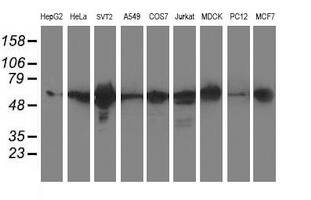 XPNPEP3 Antibody (OTI2D5) Western Blot;XPNPEP3 Antibody (OTI2D5)[NBP3-44642]-