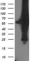 XPNPEP3 Antibody (OTI2D5) Western Blot;XPNPEP3 Antibody (OTI2D5)[NBP3-44642]-