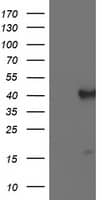 PECI Antibody (OTI1H4) Western Blot;PECI Antibody (OTI1H4)[NBP3-44643]-