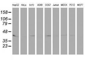 PECI Antibody (OTI1C8) Western Blot;PECI Antibody (OTI1C8)[NBP3-44644]-