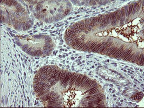Tyrosine Hydroxylase Antibody (OTI1A10) Immunohistochemistry;Tyrosine Hydroxylase Antibody (OTI1A10)[NBP3-44649]-