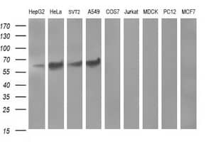Tyrosine Hydroxylase Antibody (OTI1A10) Western Blot;Tyrosine Hydroxylase Antibody (OTI1A10)[NBP3-44649]-