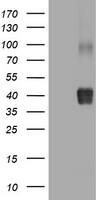 NEU-1/Sialidase-1 Antibody (OTI3B3) Western Blot;NEU-1/Sialidase-1 Antibody (OTI3B3)[NBP3-44669]-