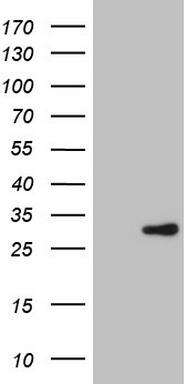 XPD Antibody (OTI4B11) Western Blot;XPD Antibody (OTI4B11)[NBP3-44677]-