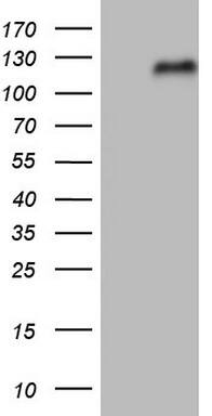 Nrf2 Antibody (OTI8A10) Western Blot;Nrf2 Antibody (OTI8A10)[NBP3-44685]-