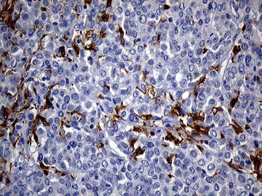 UBE3B Antibody (OTI3F10) Immunohistochemistry;UBE3B Antibody (OTI3F10)[NBP3-44687]-