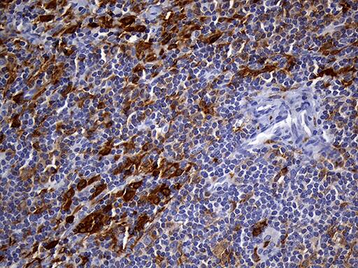 UBE3B Antibody (OTI3F10) Immunohistochemistry;UBE3B Antibody (OTI3F10)[NBP3-44687]-