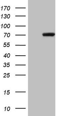 PAPSS2 Antibody (OTI1E12) Western Blot;PAPSS2 Antibody (OTI1E12)[NBP3-44690]-