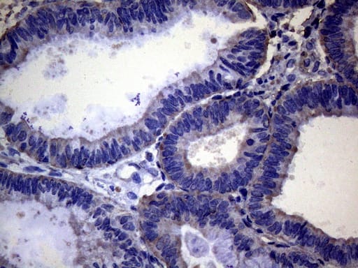 PAPSS2 Antibody (OTI6H10) Immunohistochemistry;PAPSS2 Antibody (OTI6H10)[NBP3-44692]-