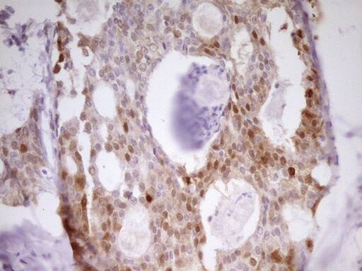 PAPSS2 Antibody (OTI2E7) Immunohistochemistry;PAPSS2 Antibody (OTI2E7)[NBP3-44693]-