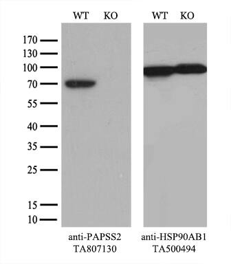 PAPSS2 Antibody (OTI2E7) Western Blot;PAPSS2 Antibody (OTI2E7)[NBP3-44693]-