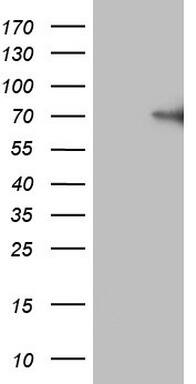 Factor XII Antibody (OTI2D12) Western Blot;Factor XII Antibody (OTI2D12)[NBP3-44694]-