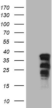 SOX21 Antibody (OTI7D5) Western Blot;SOX21 Antibody (OTI7D5)[NBP3-44697]-