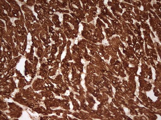 Cardiac Troponin T Antibody (OTI7D2) Immunohistochemistry;Cardiac Troponin T Antibody (OTI7D2)[NBP3-44698]-