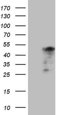 Cardiac Troponin T Antibody (OTI7D2) Western Blot;Cardiac Troponin T Antibody (OTI7D2)[NBP3-44698]-
