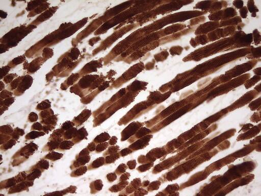Cardiac Troponin T Antibody (OTI3C3) Immunohistochemistry;Cardiac Troponin T Antibody (OTI3C3)[NBP3-44700]-