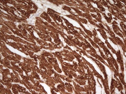 Cardiac Troponin T Antibody (OTI3C3) Immunohistochemistry;Cardiac Troponin T Antibody (OTI3C3)[NBP3-44700]-