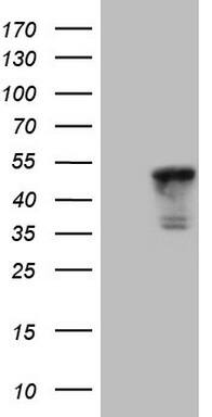 Cardiac Troponin T Antibody (OTI3C3) Western Blot;Cardiac Troponin T Antibody (OTI3C3)[NBP3-44700]-